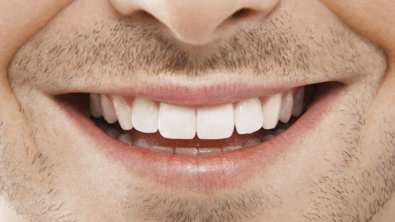Dents blanches pour un plus beau sourire !